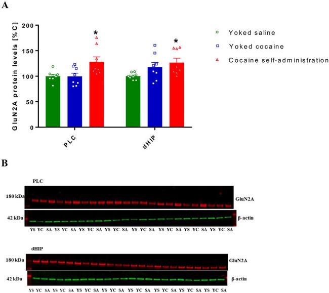 NMDAR2A Antibody in Western Blot (WB)