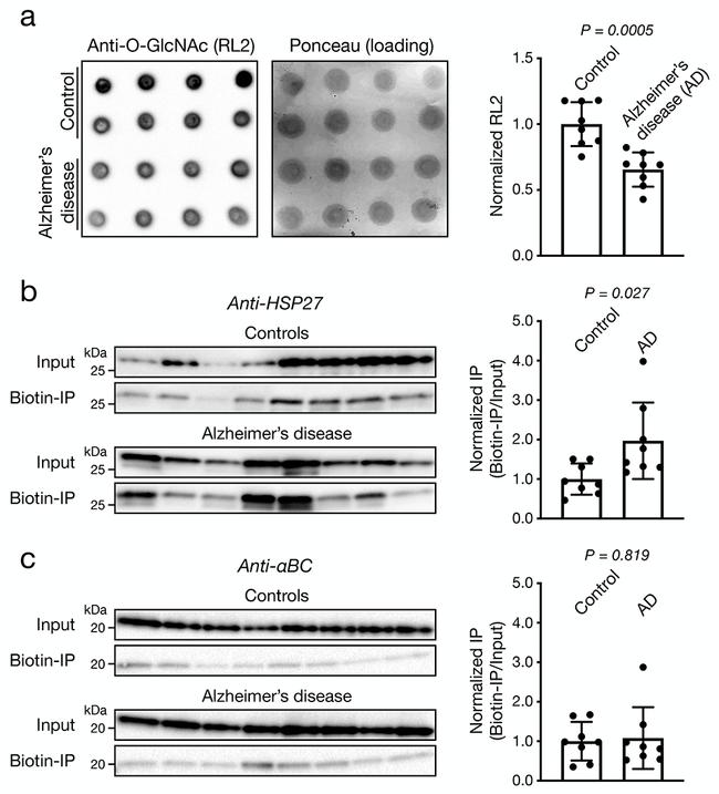 O-linked N-acetylglucosamine (O-GlcNAc) Antibody in Western Blot (WB)