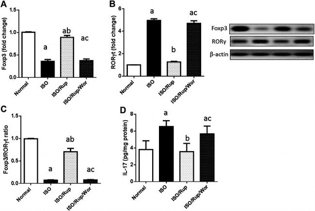 ROR gamma Antibody in Western Blot (WB)