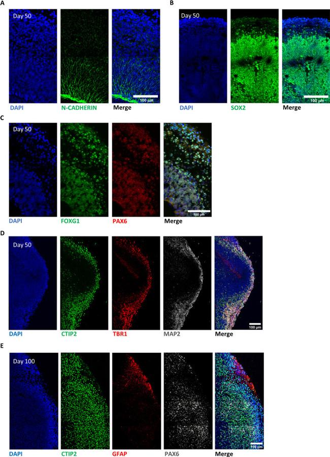 SOX2 Antibody in Immunohistochemistry (IHC)