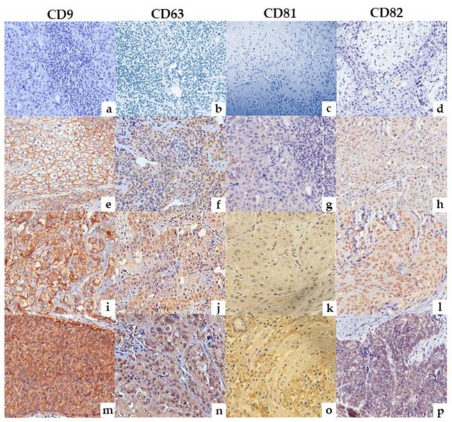 CD63 Antibody in Immunohistochemistry (IHC)