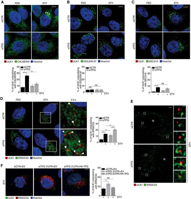 Golgin-97 Antibody in Immunocytochemistry (ICC/IF)