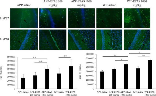 Phospho-HSP27 (Ser15) Antibody in Immunohistochemistry (IHC)