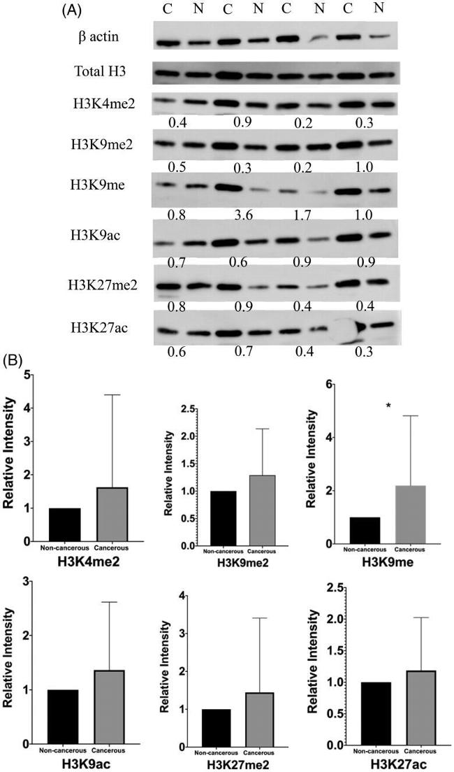 H3K4me2 Antibody in Western Blot (WB)