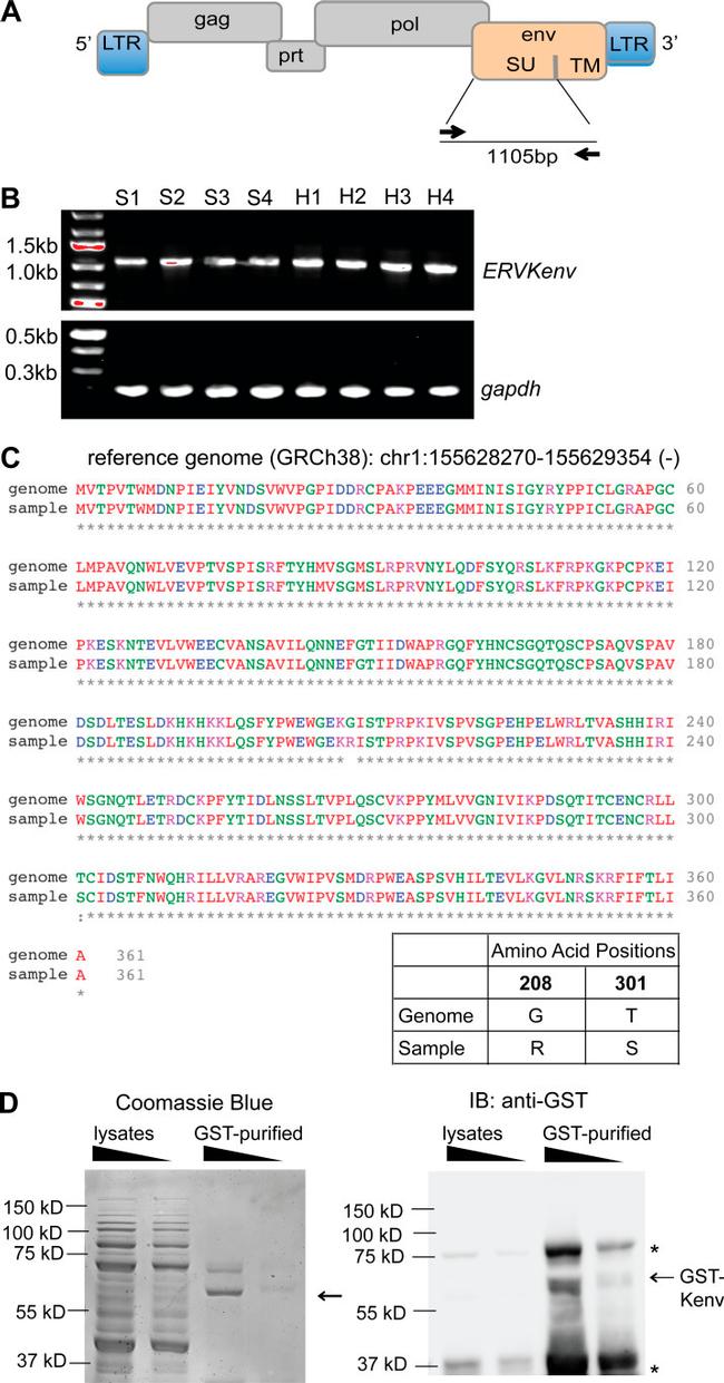 GST Tag Antibody in Western Blot (WB)