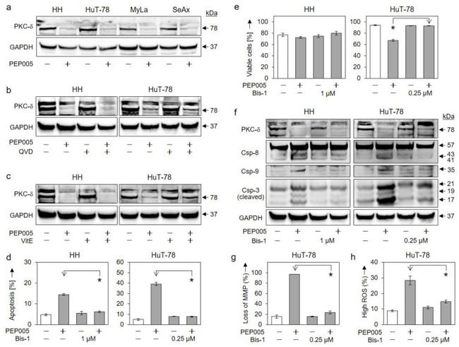 PKC delta Antibody in Western Blot (WB)