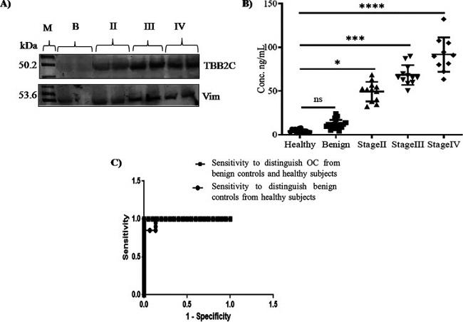 Tubulin beta-2C Antibody in Western Blot (WB)