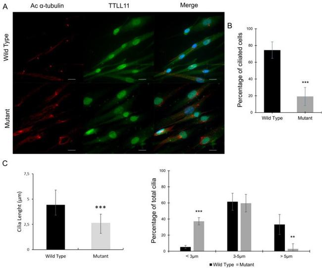 TTLL11 Antibody in Immunocytochemistry (ICC/IF)