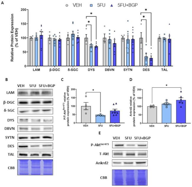 SNTB2 Antibody in Western Blot (WB)