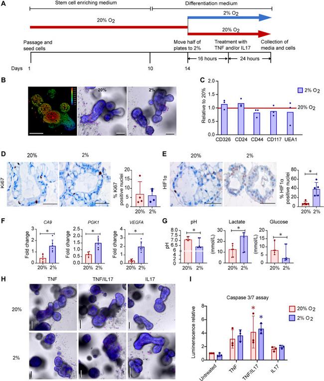 HIF1A Antibody in Immunohistochemistry, Immunohistochemistry (Paraffin) (IHC, IHC (P))