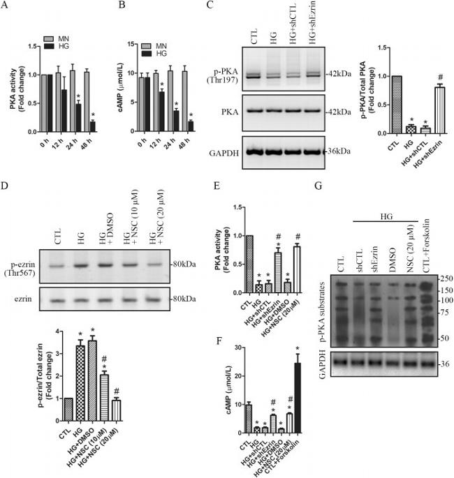 Ezrin Antibody in Western Blot (WB)