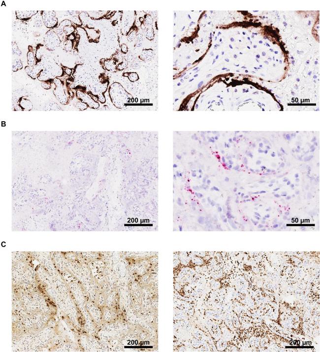 SARS/SARS-CoV-2 Nucleocapsid Antibody in Immunohistochemistry (IHC)