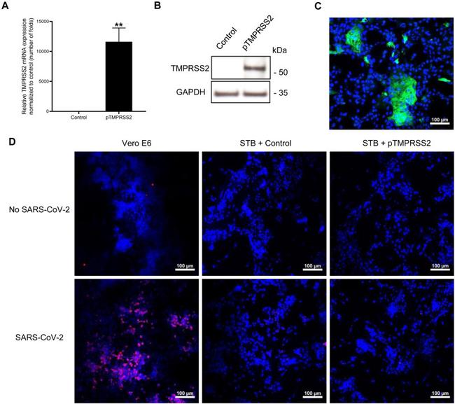 SARS/SARS-CoV-2 Nucleocapsid Antibody in Immunohistochemistry (IHC)