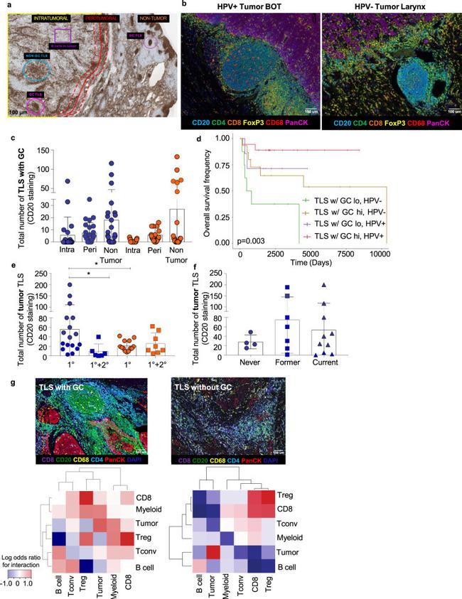 CD20 Antibody in Immunohistochemistry (IHC)