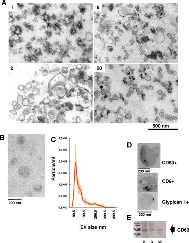 Glypican 1 Antibody in Immunohistochemistry (IHC)