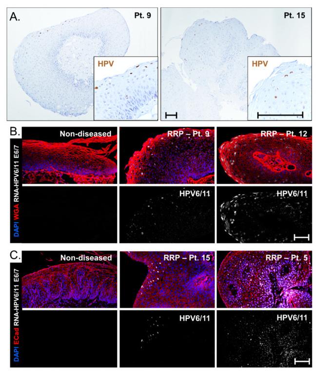 Dinitrophenyl-KLH Antibody in Immunohistochemistry (IHC)