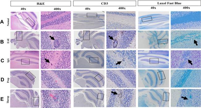 CD3e Antibody in Immunohistochemistry (IHC)