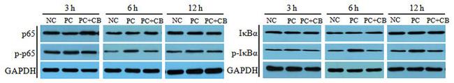 IkB alpha Antibody in Western Blot (WB)