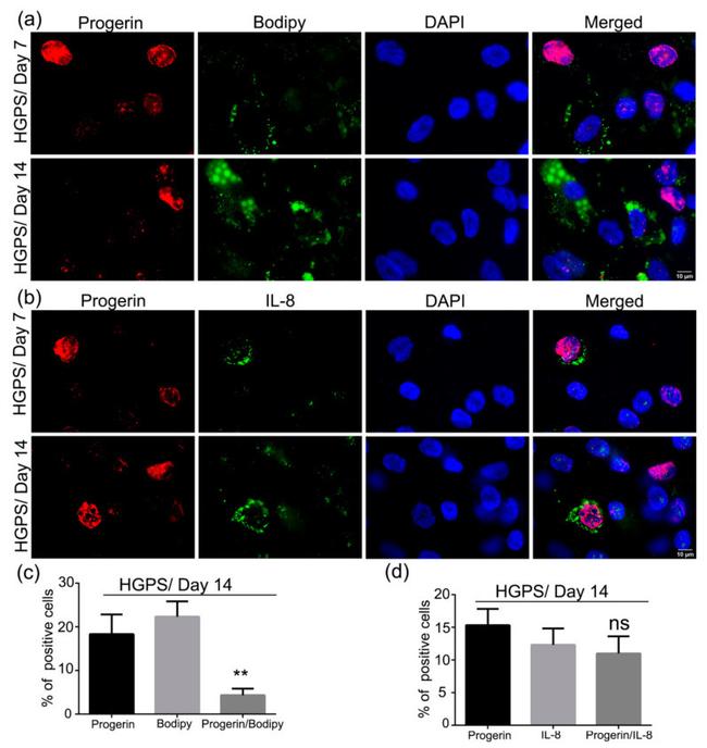 IL-8 (CXCL8) Antibody in Immunocytochemistry (ICC/IF)