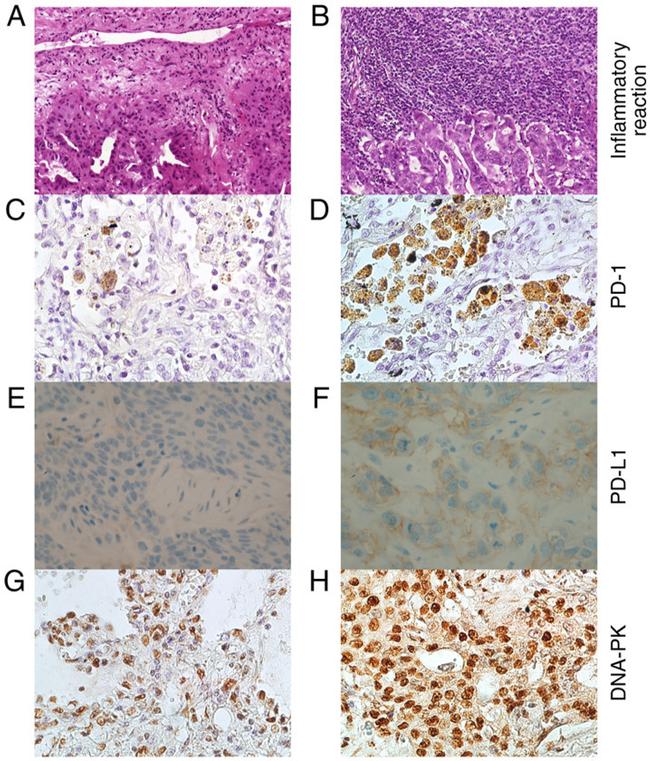 PD-L1 Antibody in Immunohistochemistry (IHC)