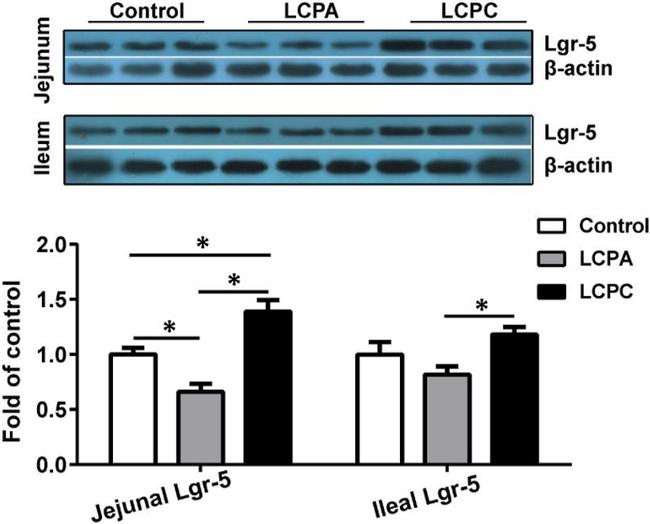 LGR5 Antibody in Western Blot (WB)