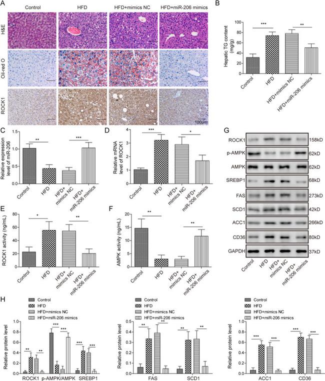 ROCK1 Antibody in Immunohistochemistry (IHC)