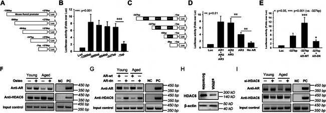 HDAC6 Antibody in ChIP Assay (ChIP)