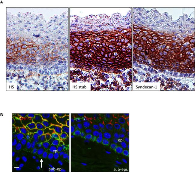 CD138 Antibody in Immunohistochemistry (IHC)