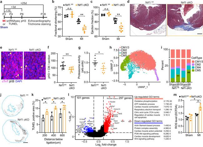 Cardiac Troponin T Antibody in Immunohistochemistry (IHC)