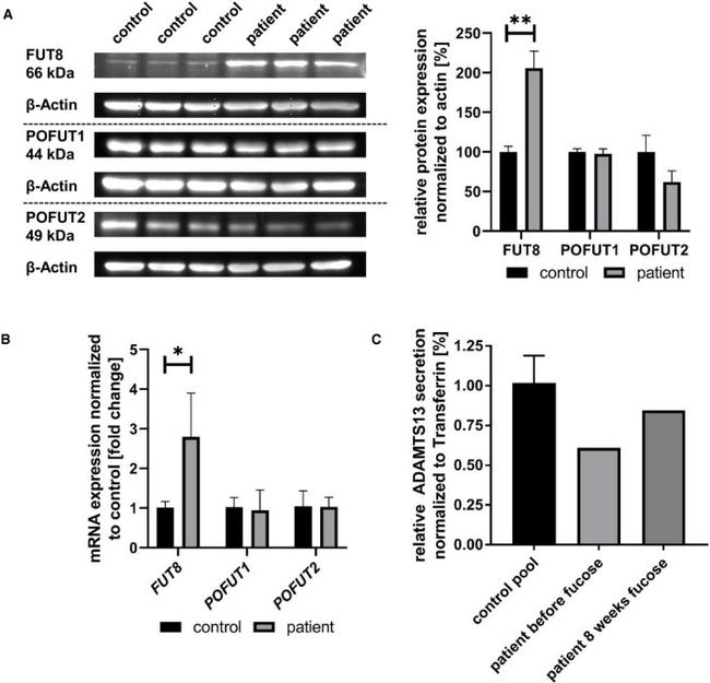 ADAMTS13 Antibody in Western Blot (WB)