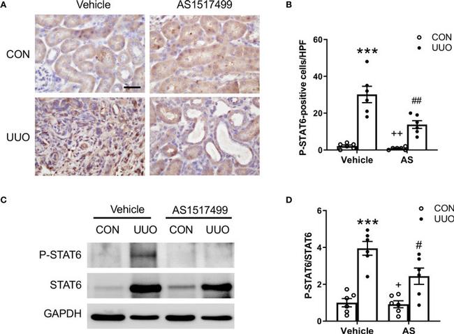 Phospho-STAT6 (Tyr641) Antibody in Immunohistochemistry (IHC)