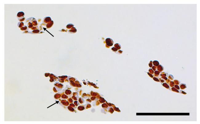 Survivin Antibody in Immunohistochemistry (IHC)