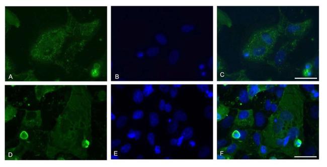 SARS/SARS-CoV-2 Nucleocapsid Antibody in Immunocytochemistry (ICC/IF)