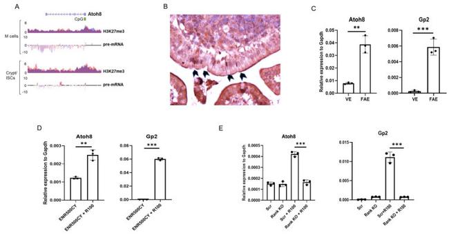 ATOH8 Antibody in Immunohistochemistry (IHC)