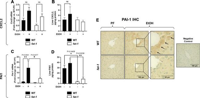 PAI1 Antibody in Immunohistochemistry (IHC)