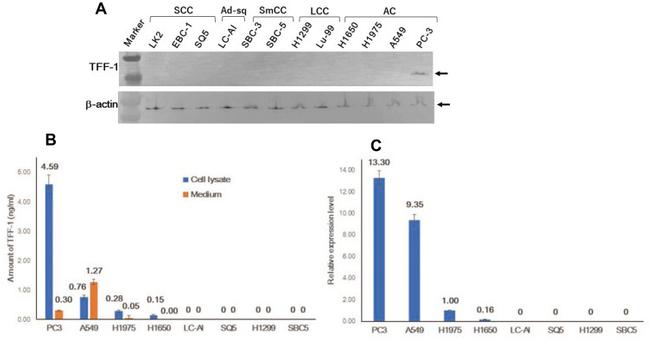 TFF1 Antibody in Western Blot (WB)