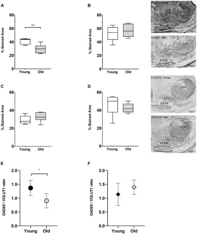 VGLUT1 Antibody in Immunohistochemistry (IHC)