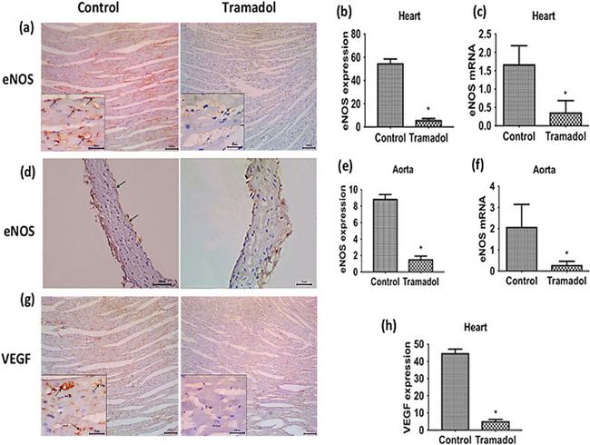 eNOS Antibody in Immunohistochemistry (IHC)