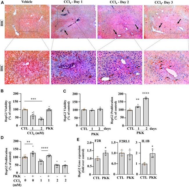 Plasma Kallikrein Antibody in Immunohistochemistry (IHC)