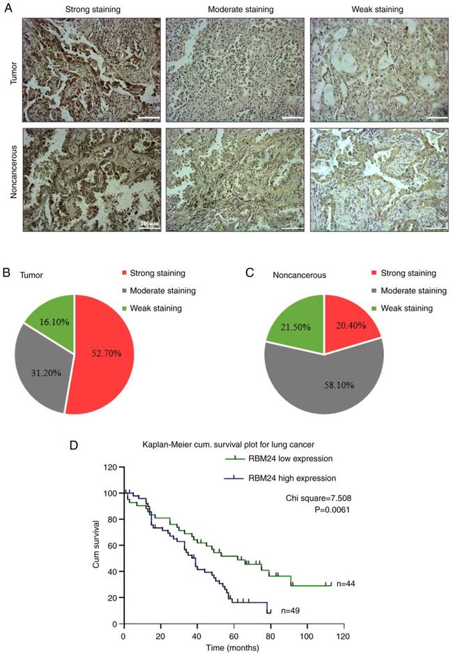 RBM24 Antibody in Immunohistochemistry (IHC)