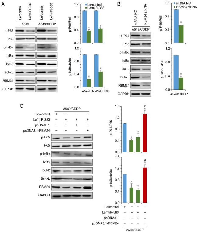 RBM24 Antibody in Western Blot (WB)