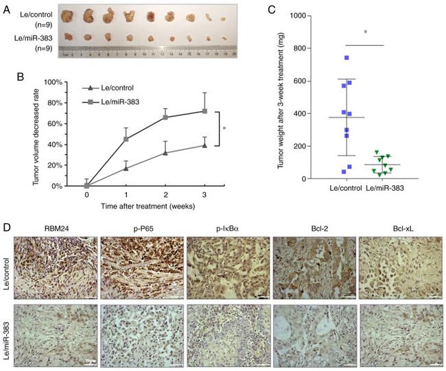 RBM24 Antibody in Immunohistochemistry (IHC)