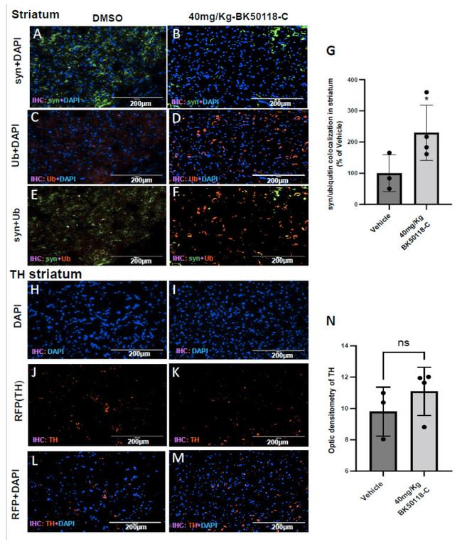 alpha Synuclein Antibody in Immunohistochemistry (IHC)