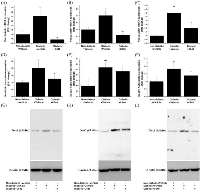 NOX2 Antibody in Western Blot (WB)