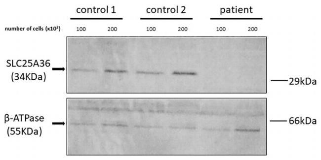 SLC25A36 Antibody in Western Blot (WB)