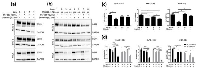 EGFR Antibody in Western Blot (WB)