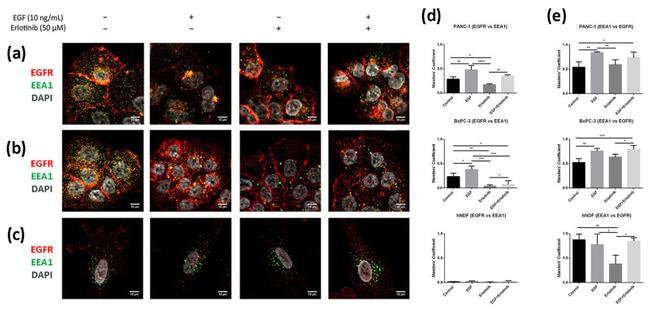 EEA1 Antibody in Immunocytochemistry (ICC/IF)