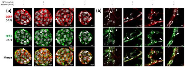 EEA1 Antibody in Immunocytochemistry (ICC/IF)