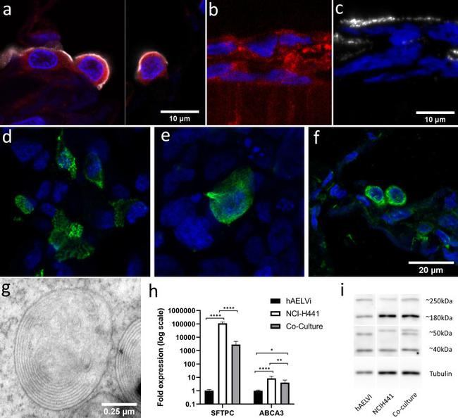 ABCA3 Antibody in Immunocytochemistry (ICC/IF)