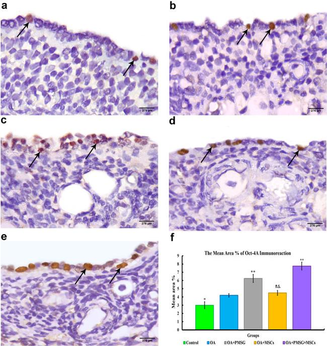 OCT4 Antibody in Immunohistochemistry (IHC)